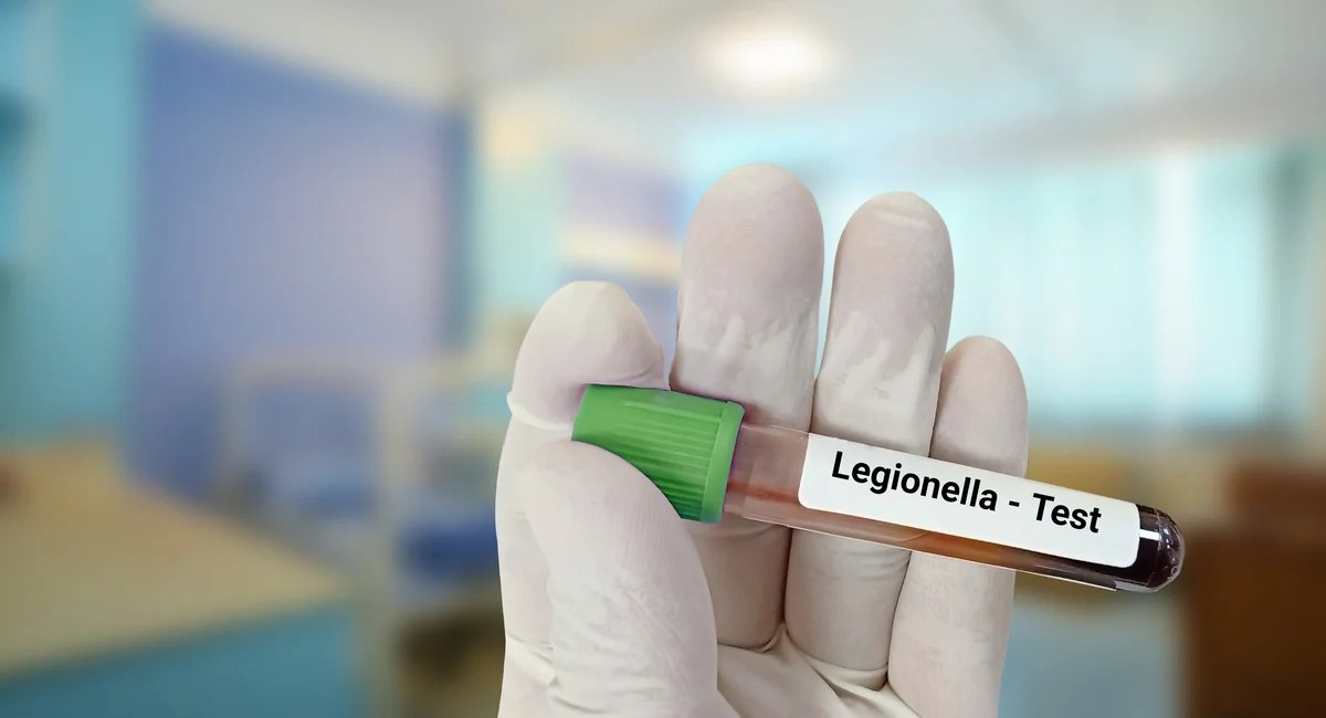 Legionnaires' Disease Outbreak: UES Buildings with Positive Legionella Tests Double - Full Update (2026)